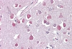 ETV1 Rabbit anti-Human, Polyclonal, Novus Biologicals 100 μg; Unconjugated:Antibodies,